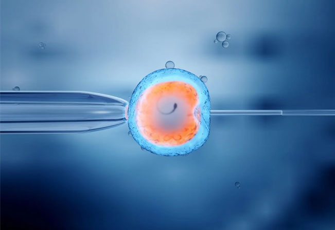 IVF Image